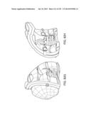 PATIENT-ADAPTED AND IMPROVED ARTICULAR IMPLANTS, DESIGNS AND RELATED GUIDE     TOOLS diagram and image