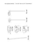 PATIENT-ADAPTED AND IMPROVED ARTICULAR IMPLANTS, DESIGNS AND RELATED GUIDE     TOOLS diagram and image