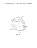 PATIENT-ADAPTED AND IMPROVED ARTICULAR IMPLANTS, DESIGNS AND RELATED GUIDE     TOOLS diagram and image