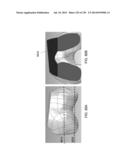 PATIENT-ADAPTED AND IMPROVED ARTICULAR IMPLANTS, DESIGNS AND RELATED GUIDE     TOOLS diagram and image