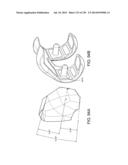 PATIENT-ADAPTED AND IMPROVED ARTICULAR IMPLANTS, DESIGNS AND RELATED GUIDE     TOOLS diagram and image