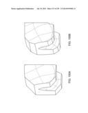 PATIENT-ADAPTED AND IMPROVED ARTICULAR IMPLANTS, DESIGNS AND RELATED GUIDE     TOOLS diagram and image