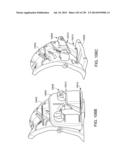 PATIENT-ADAPTED AND IMPROVED ARTICULAR IMPLANTS, DESIGNS AND RELATED GUIDE     TOOLS diagram and image