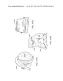 PATIENT-ADAPTED AND IMPROVED ARTICULAR IMPLANTS, DESIGNS AND RELATED GUIDE     TOOLS diagram and image