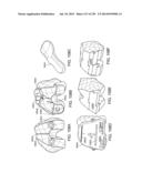 PATIENT-ADAPTED AND IMPROVED ARTICULAR IMPLANTS, DESIGNS AND RELATED GUIDE     TOOLS diagram and image