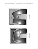 PATIENT-ADAPTED AND IMPROVED ARTICULAR IMPLANTS, DESIGNS AND RELATED GUIDE     TOOLS diagram and image