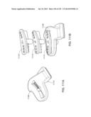 PATIENT-ADAPTED AND IMPROVED ARTICULAR IMPLANTS, DESIGNS AND RELATED GUIDE     TOOLS diagram and image