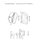 PATIENT-ADAPTED AND IMPROVED ARTICULAR IMPLANTS, DESIGNS AND RELATED GUIDE     TOOLS diagram and image