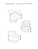 PATIENT-ADAPTED AND IMPROVED ARTICULAR IMPLANTS, DESIGNS AND RELATED GUIDE     TOOLS diagram and image