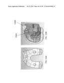 PATIENT-ADAPTED AND IMPROVED ARTICULAR IMPLANTS, DESIGNS AND RELATED GUIDE     TOOLS diagram and image