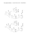 PATIENT-ADAPTED AND IMPROVED ARTICULAR IMPLANTS, DESIGNS AND RELATED GUIDE     TOOLS diagram and image