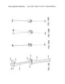 PATIENT-ADAPTED AND IMPROVED ARTICULAR IMPLANTS, DESIGNS AND RELATED GUIDE     TOOLS diagram and image