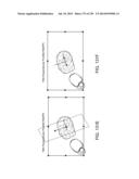 PATIENT-ADAPTED AND IMPROVED ARTICULAR IMPLANTS, DESIGNS AND RELATED GUIDE     TOOLS diagram and image