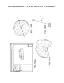 PATIENT-ADAPTED AND IMPROVED ARTICULAR IMPLANTS, DESIGNS AND RELATED GUIDE     TOOLS diagram and image