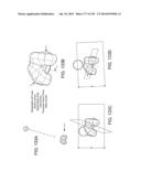 PATIENT-ADAPTED AND IMPROVED ARTICULAR IMPLANTS, DESIGNS AND RELATED GUIDE     TOOLS diagram and image