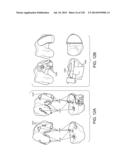 PATIENT-ADAPTED AND IMPROVED ARTICULAR IMPLANTS, DESIGNS AND RELATED GUIDE     TOOLS diagram and image