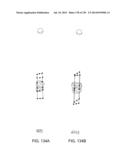 PATIENT-ADAPTED AND IMPROVED ARTICULAR IMPLANTS, DESIGNS AND RELATED GUIDE     TOOLS diagram and image