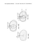 PATIENT-ADAPTED AND IMPROVED ARTICULAR IMPLANTS, DESIGNS AND RELATED GUIDE     TOOLS diagram and image