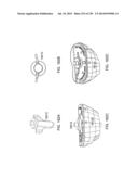 PATIENT-ADAPTED AND IMPROVED ARTICULAR IMPLANTS, DESIGNS AND RELATED GUIDE     TOOLS diagram and image