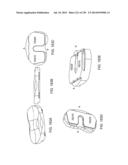 PATIENT-ADAPTED AND IMPROVED ARTICULAR IMPLANTS, DESIGNS AND RELATED GUIDE     TOOLS diagram and image