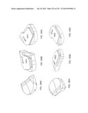 PATIENT-ADAPTED AND IMPROVED ARTICULAR IMPLANTS, DESIGNS AND RELATED GUIDE     TOOLS diagram and image