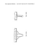 PATIENT-ADAPTED AND IMPROVED ARTICULAR IMPLANTS, DESIGNS AND RELATED GUIDE     TOOLS diagram and image