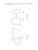 PATIENT-ADAPTED AND IMPROVED ARTICULAR IMPLANTS, DESIGNS AND RELATED GUIDE     TOOLS diagram and image