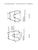 PATIENT-ADAPTED AND IMPROVED ARTICULAR IMPLANTS, DESIGNS AND RELATED GUIDE     TOOLS diagram and image