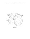 PATIENT-ADAPTED AND IMPROVED ARTICULAR IMPLANTS, DESIGNS AND RELATED GUIDE     TOOLS diagram and image