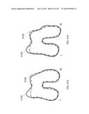 PATIENT-ADAPTED AND IMPROVED ARTICULAR IMPLANTS, DESIGNS AND RELATED GUIDE     TOOLS diagram and image