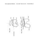 PATIENT-ADAPTED AND IMPROVED ARTICULAR IMPLANTS, DESIGNS AND RELATED GUIDE     TOOLS diagram and image