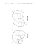 PATIENT-ADAPTED AND IMPROVED ARTICULAR IMPLANTS, DESIGNS AND RELATED GUIDE     TOOLS diagram and image