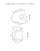 PATIENT-ADAPTED AND IMPROVED ARTICULAR IMPLANTS, DESIGNS AND RELATED GUIDE     TOOLS diagram and image