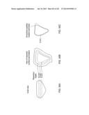 PATIENT-ADAPTED AND IMPROVED ARTICULAR IMPLANTS, DESIGNS AND RELATED GUIDE     TOOLS diagram and image