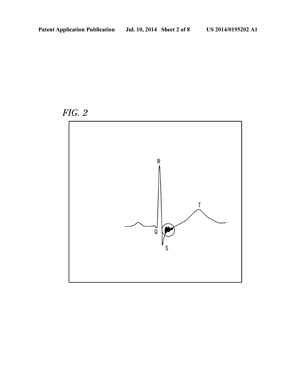 BIOLOGICAL SIGNAL AVERAGING PROCESSING DEVICE - diagram, schematic, and image 03