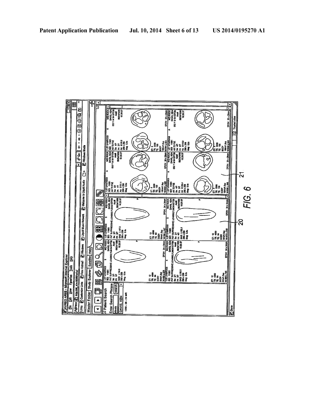 Electronic Method and System that Improves Efficiencies for Rendering     Diagnosis of Radiology Procedures - diagram, schematic, and image 07