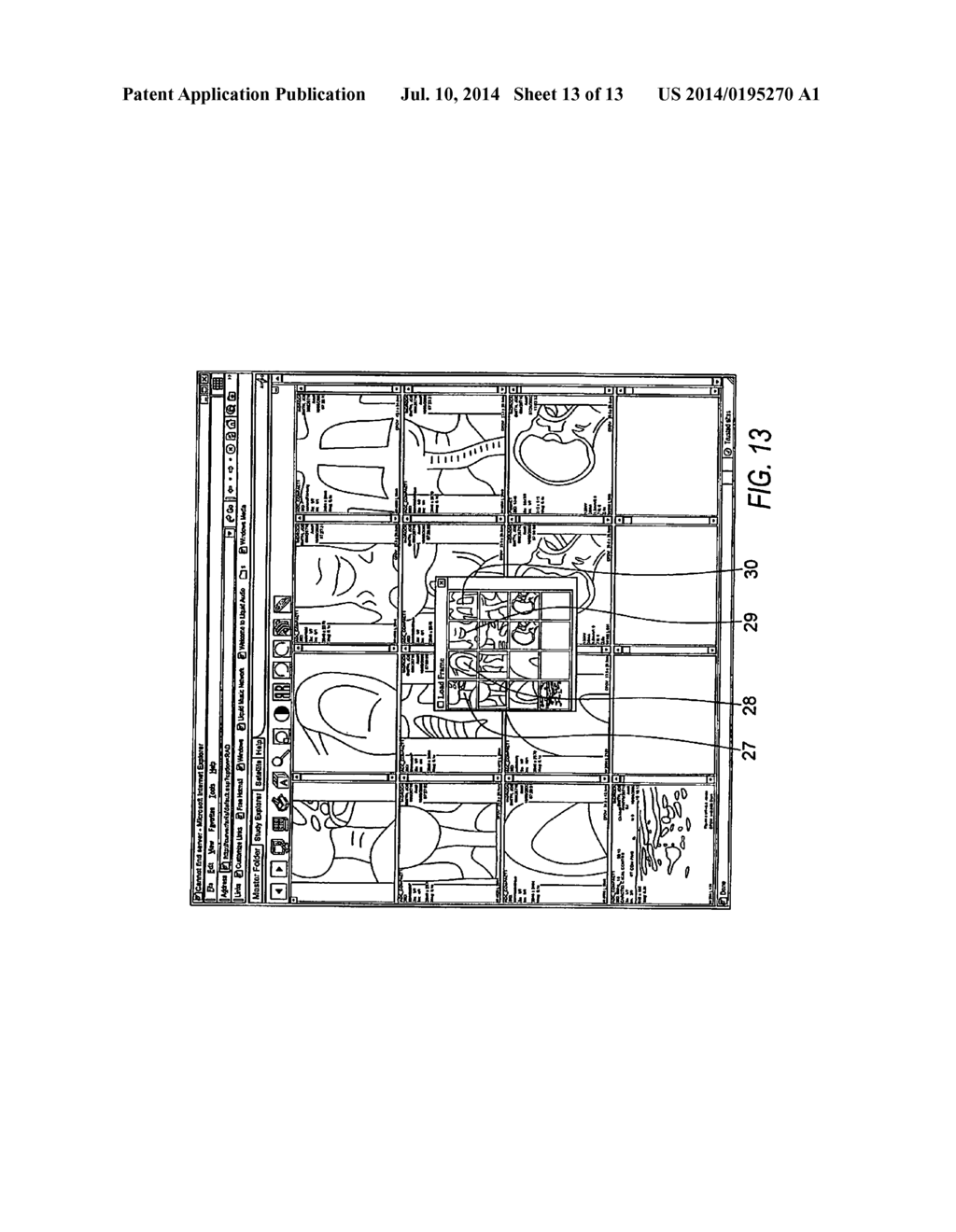 Electronic Method and System that Improves Efficiencies for Rendering     Diagnosis of Radiology Procedures - diagram, schematic, and image 14