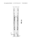 Liner Hanger/Packer Apparatus with Pressure Balance Feature on Anchor     Slips to Facilitate Removal diagram and image