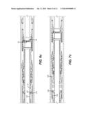 Liner Hanger/Packer Apparatus with Pressure Balance Feature on Anchor     Slips to Facilitate Removal diagram and image