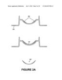 Method of Ring-Shaped Structure Placement in an Eye-Mountable Device diagram and image