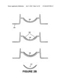 Method of Ring-Shaped Structure Placement in an Eye-Mountable Device diagram and image