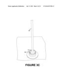 Method of Ring-Shaped Structure Placement in an Eye-Mountable Device diagram and image