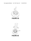 Method of Ring-Shaped Structure Placement in an Eye-Mountable Device diagram and image