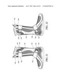 CIRCUMFERENTIAL WALKER diagram and image