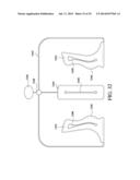 CIRCUMFERENTIAL WALKER diagram and image