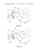 CIRCUMFERENTIAL WALKER diagram and image