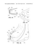 CIRCUMFERENTIAL WALKER diagram and image