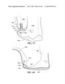 CIRCUMFERENTIAL WALKER diagram and image