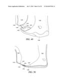 CIRCUMFERENTIAL WALKER diagram and image