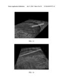 PREVENTION OF FRETTING CREVICE CORROSION OF MODULAR TAPER INTERFACES IN     ORTHOPEDIC IMPLANTS diagram and image